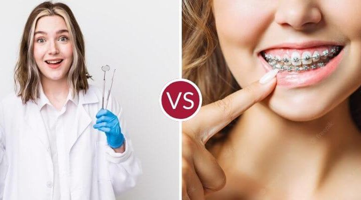 Differences Between Orthodontists and Dentists
